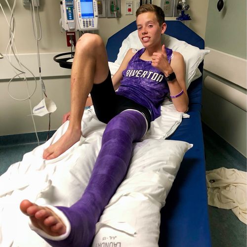 runner with broken leg in hospital